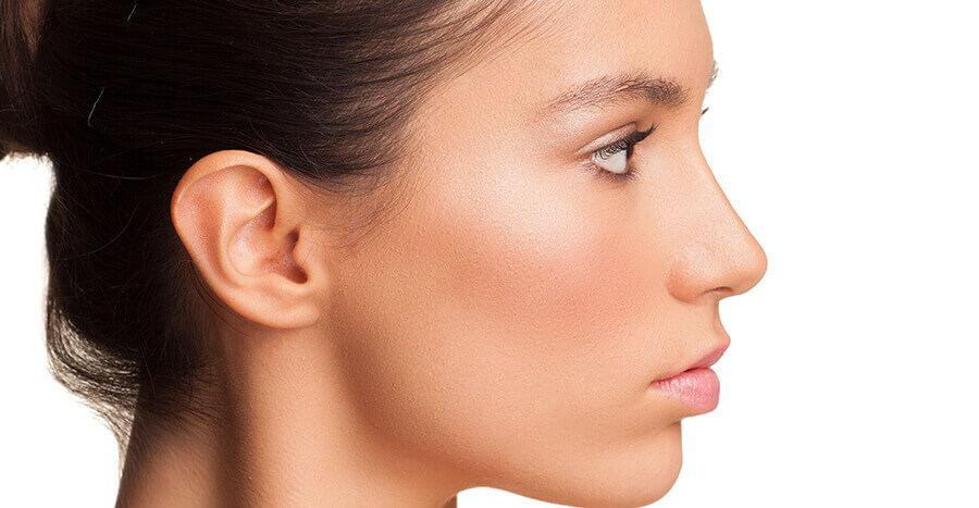 Rhinoplasty